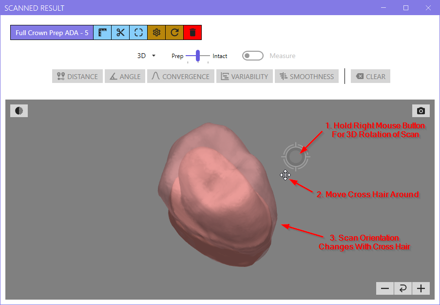 Tooth Prep Image