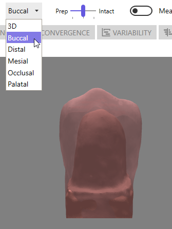 Buccal Preset View Angle