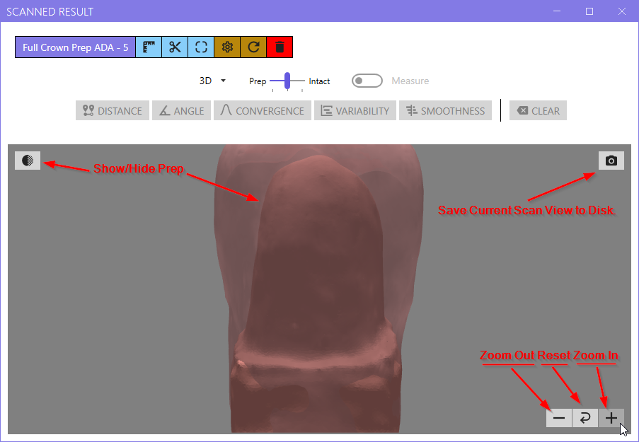 Tooth Prep View Controls