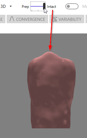 Intact View of Tooth