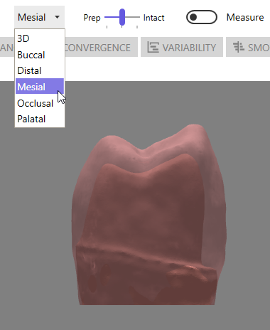 Mesial Preset View Angle
