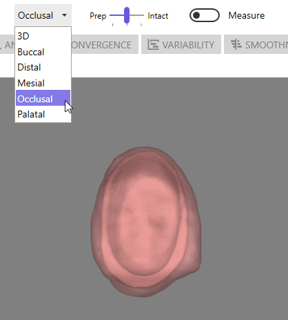 Occlusal Preset View Angle