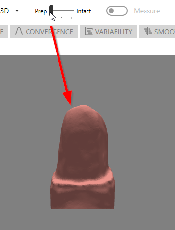 Prep View of Tooth