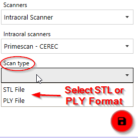 Intraoral Scanner selection with scan type dropdown showing STL and PLY file format options.